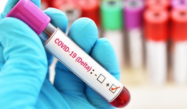 Над 1300 положителни проби за COVID-19